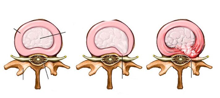 Change blood vessels