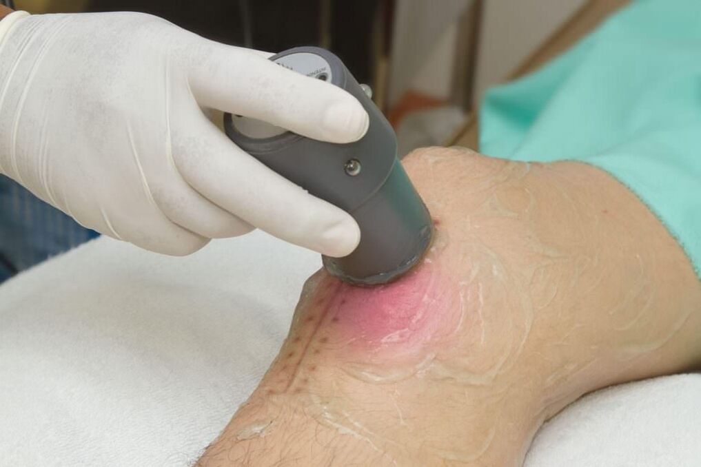 Electrophoresis procedure for knee arthritis