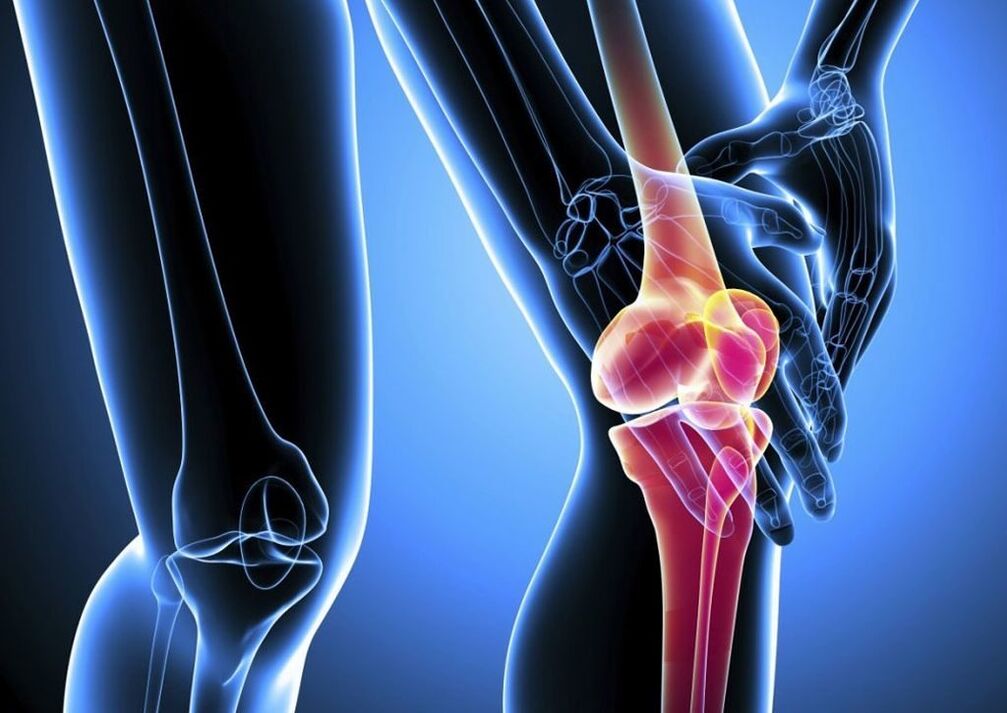 Pain during physical activity in knee osteoarthritis