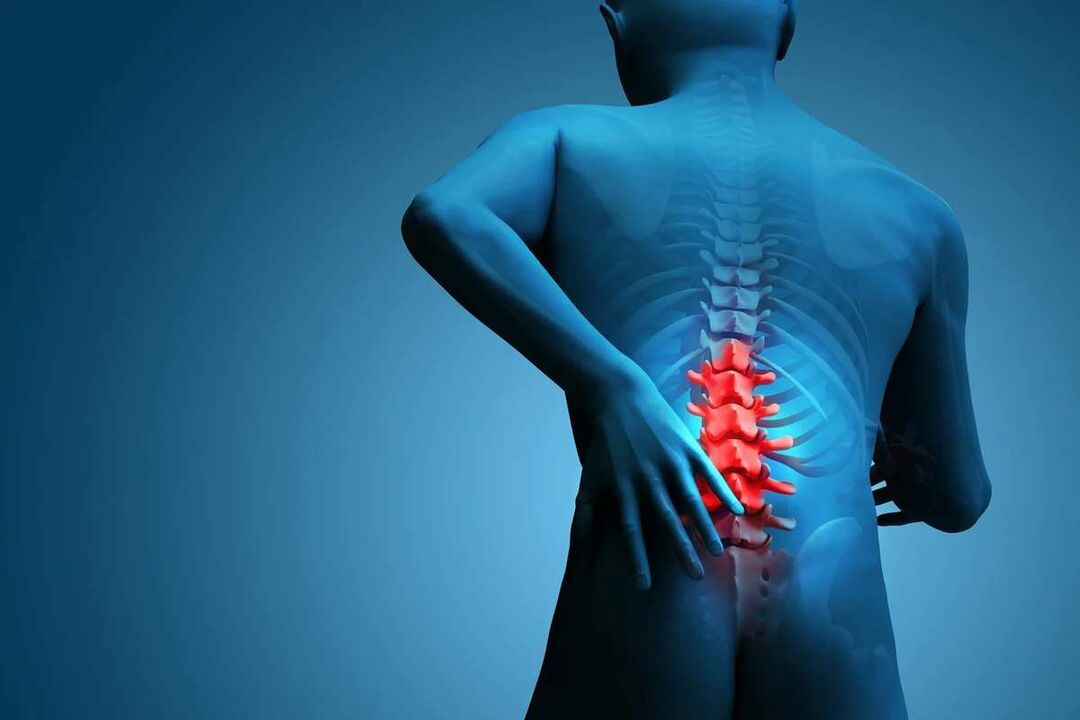 The main symptom of lumbar spondylosis is lower back pain. 