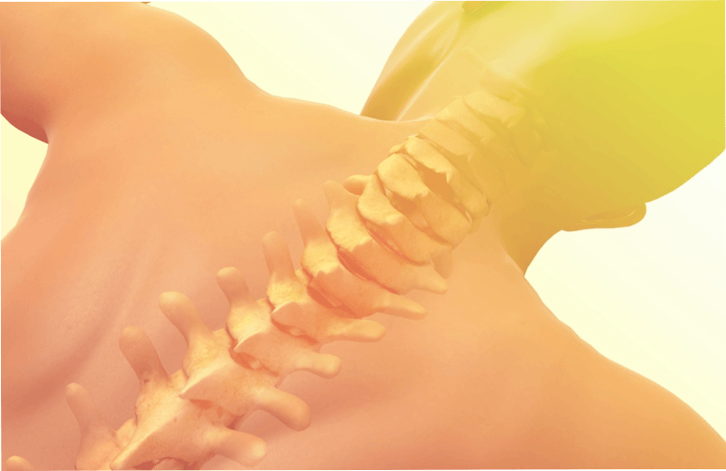 cervical spine osteonecrosis