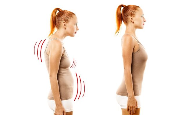 The back is the cause of the development of lumbar osteoarthritis