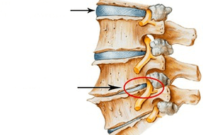 Normal spine and damage to cervical joint disease