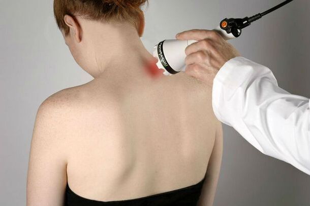 Physical therapy measures to treat cervical spondylosis