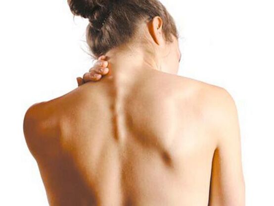 The girl has cervical spondylosis