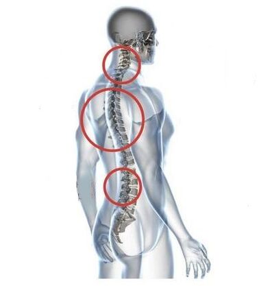 location of spinal bone degeneration
