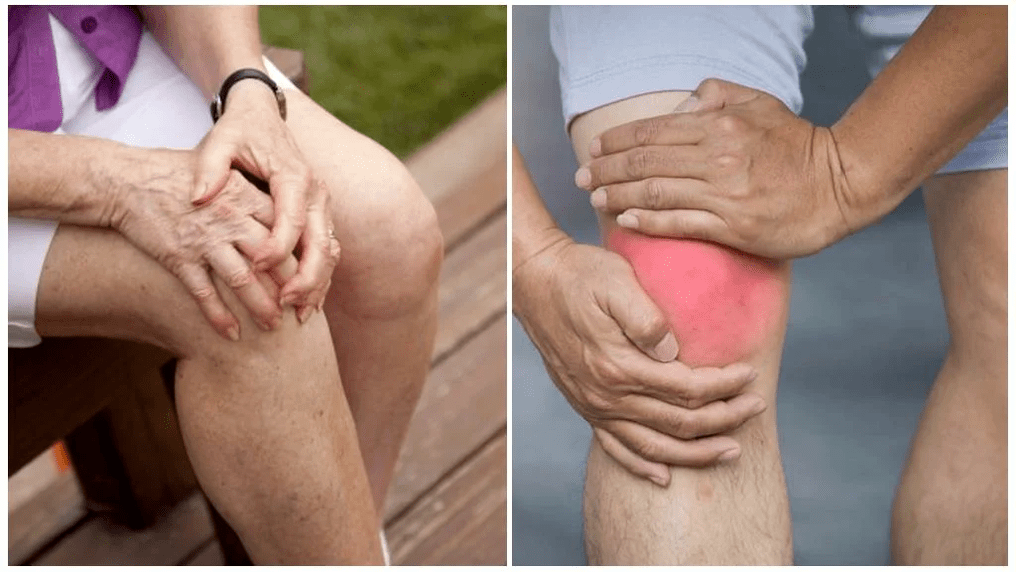 joint disease treatment
