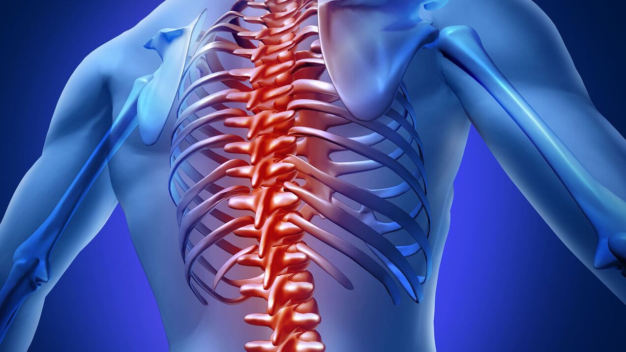 Osteoarthritis of the chest bone