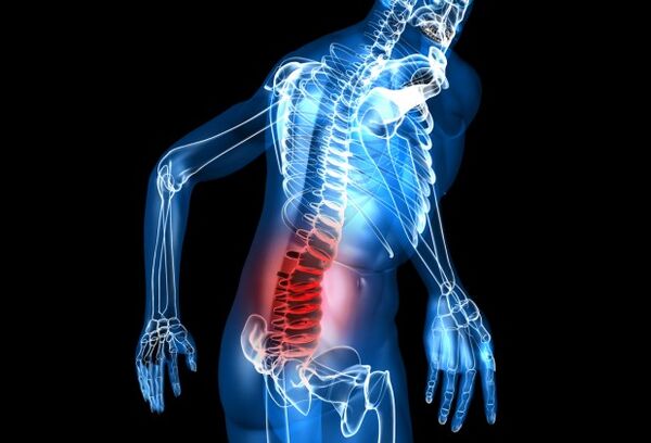 What is lumbar osteoarthritis