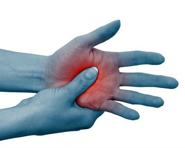 Severe pain in the finger joints, which subsides with exercise, is a typical sign of rheumatoid arthritis.